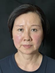 -Yestar艺星医疗美容医院