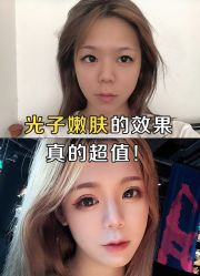 -小忠丽格医美
