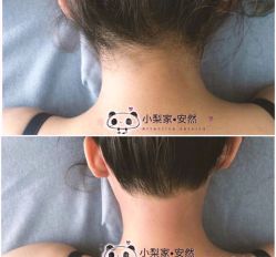 -小梨·OndaPro·专业脱毛连锁机构