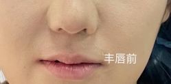 -东剑医学美容·注射美学中心