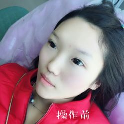 -西施无菌半永久纹绣眉眼影唇轻增发纹发际线