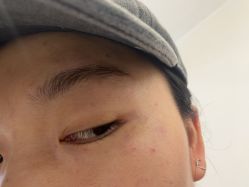 -贵阳美莱医疗美容整形医院