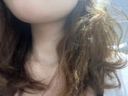 -广州美莱医疗美容医院