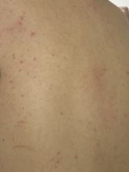 -莱可美科技美肤