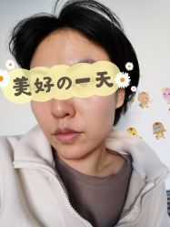 体验后-小忠丽格医美
