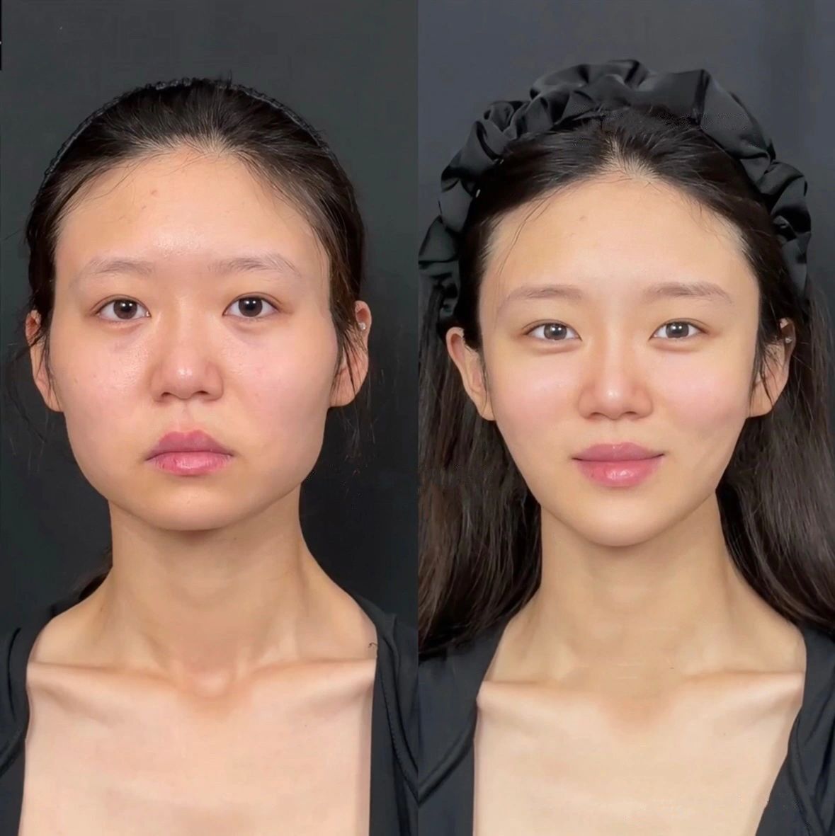 方脸也能变瓜子脸?