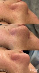 -SKIN79皮肤管理中心