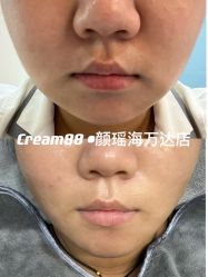 -Cream88颜皮肤管理中心