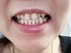 -Dr.Z dental仁康种植矫正中心