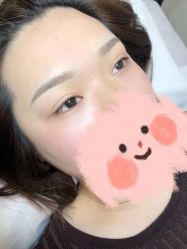 -MIVI半永久纹眉纹绣