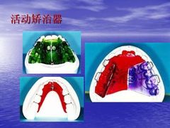 -团圆口腔·种植中心(锦江院区)