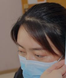 体验后-大麦微针植发全国连锁