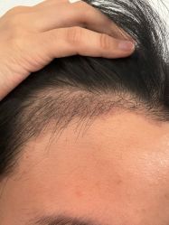 -熙朵美学植发·连锁品牌