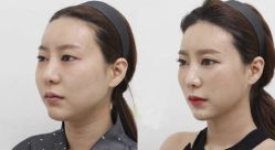 -CMS西美斯·美式医疗美容