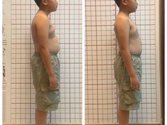 -修申骨雕小颜脊柱骨盆管理产后修复