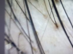 体验前-雍禾植发全国连锁