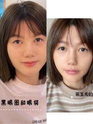 -美莱医学美容医院