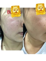 -广州美莱医疗美容医院