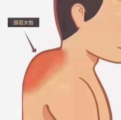 -香薇妮丝·定制减肥·身材管理