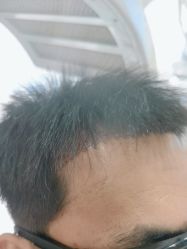 -雍禾植发全国连锁