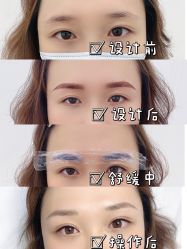 -久匠·纹眉纹绣半永久