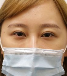 -丰联丽格医疗美容·联合丽格眼整形中心