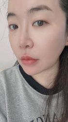 体验后-杭州米兰柏羽医疗美容医院