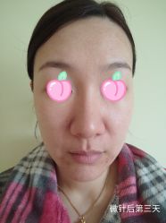 -和颜一美轻医美连锁