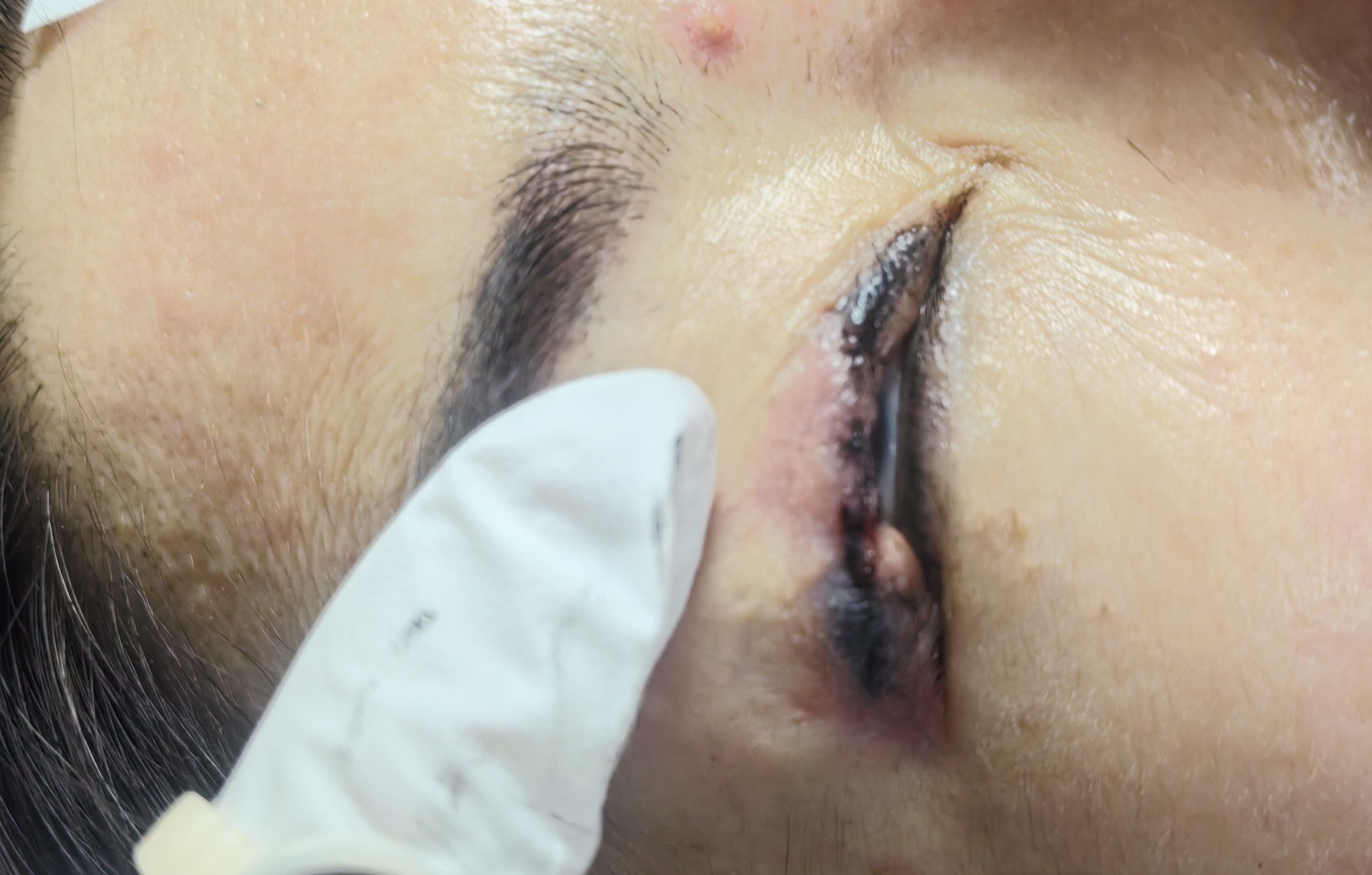 纹美睫线#纹美瞳线#半永久定妆眉眼唇#纹眼线美瞳线