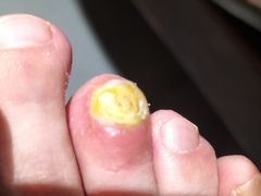 -朋朋修脚(友好广场店)