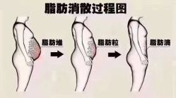 -香薇妮丝女子减肥院