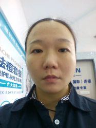 -蕾特恩专业祛痘国际连锁