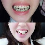 如何有效提升牙齿矫正效率？ .