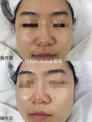 -E.beauty驻颜·痘敏肌调理中心