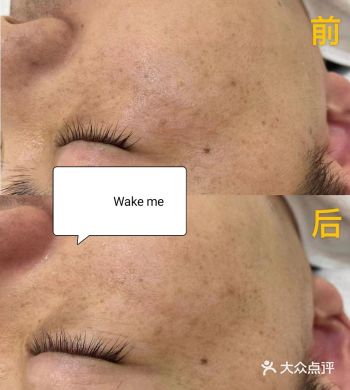 朋友经常在耳边碎碎念，要做好护肤，对自己好一点儿