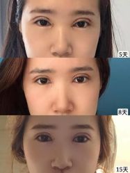 -素美医疗美容·西南眼鼻整形·修复基地