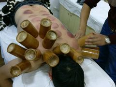 -太乙盲人推拿按摩连锁(星洲店)