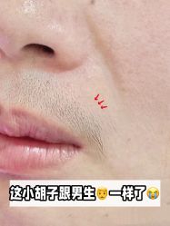 -小梨·OndaPro·专业脱毛连锁机构