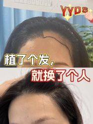 -雍禾植发全国连锁