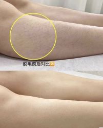 点击看大图 -智丽佳人祛斑祛痘美容美体
