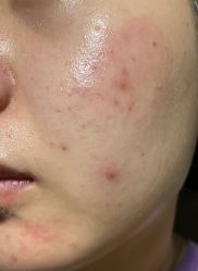 体验前-上海玫瑰医疗美容医院