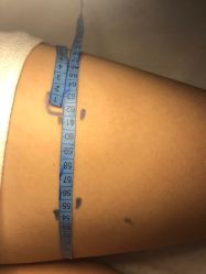 -肥三针腧穴瘦身馆