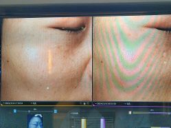 -苑苑vbeauty科技美容SPA