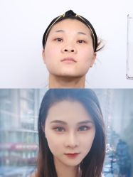 -上海时光整形外科医院