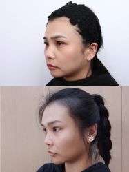-上海时光整形外科医院