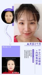 -丰联丽格医疗美容·联合丽格眼整形中心