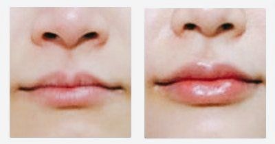 点击看大图 -SKINIST丽铂医疗美容