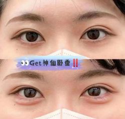 -深圳艺星医疗美容医院