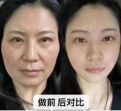 -香薇妮丝·定制减肥·身材管理