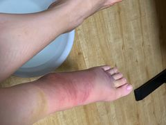 -大韩庄韩氏祖传正骨